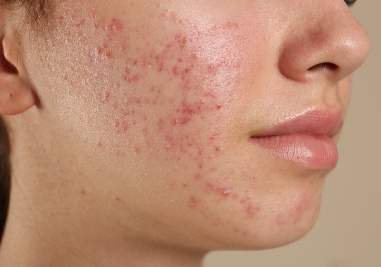 top skin specialist in pcmc