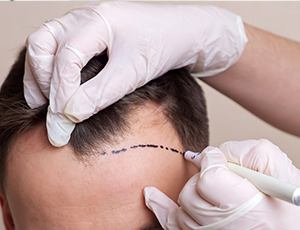 best hair clinic in Pimpri-Chinchwad